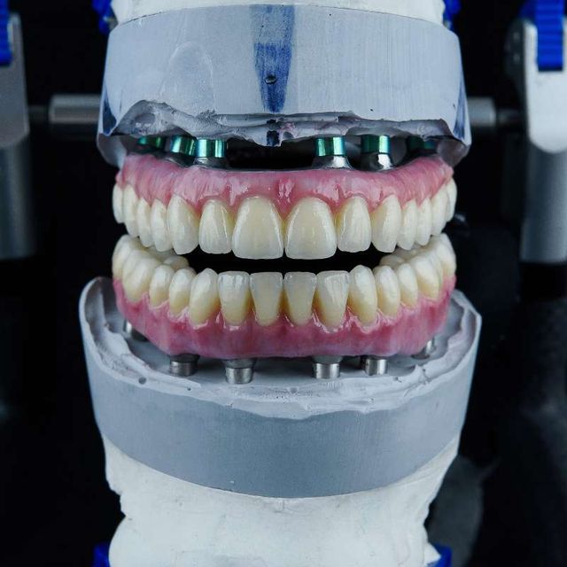 Protesis dental completa